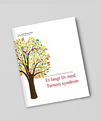 (PDF) Et langt liv med Turners syndrom